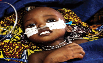 COMBATIR LA COMBINACIÓN LETAL DE MALARIA Y DESNUTRICIÓN NÍGER 2013